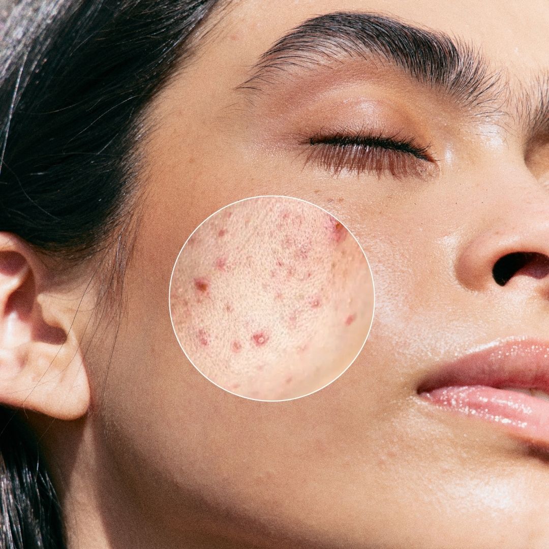 AHA + BHA Exfoliator 30 ml